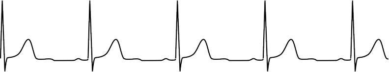 Electrocardiogramme du 27/02/2008